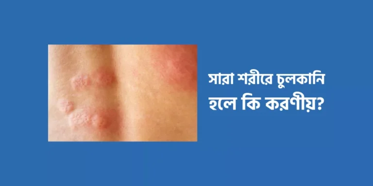 Itching on the body1