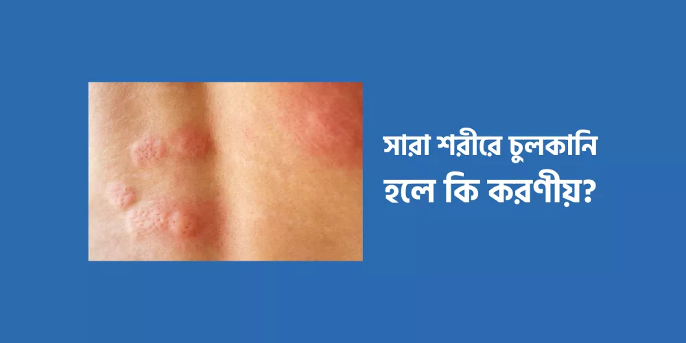 Itching on the body1