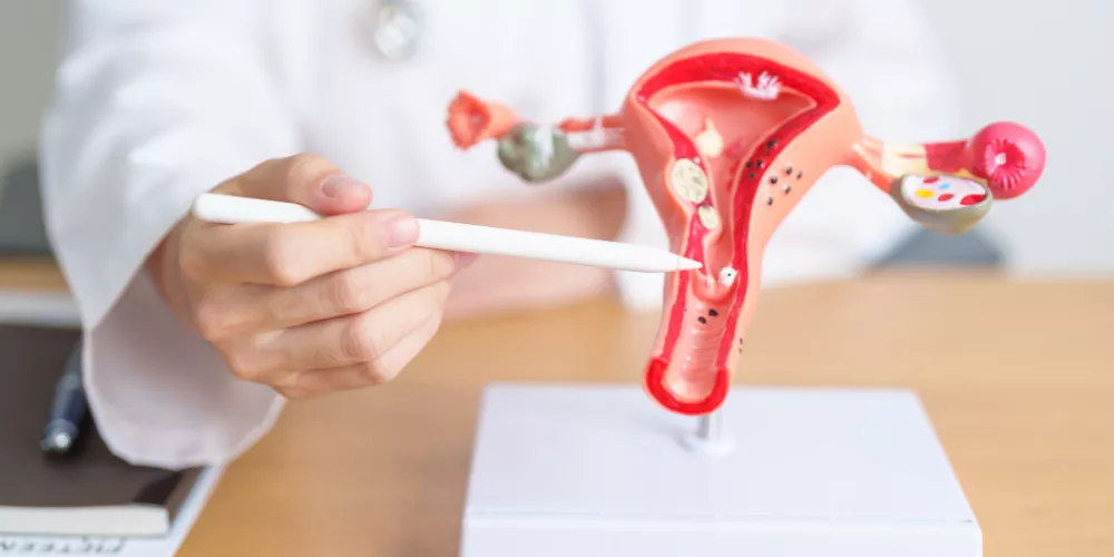 Tumor in the uterus2