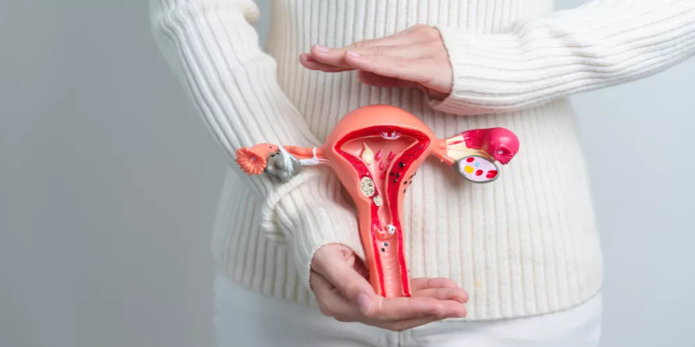 Tumor in the uterus4